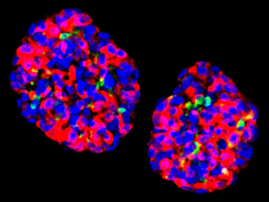 Zimislecel - nadějná léčba