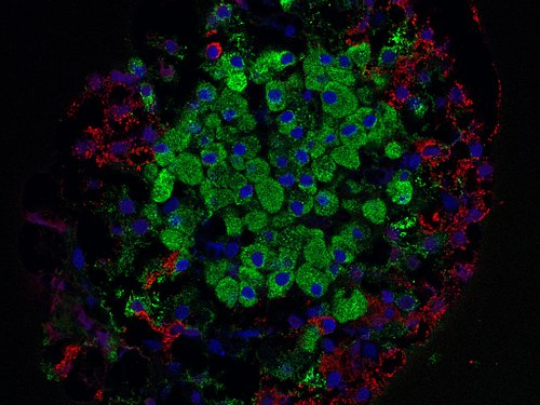 TIX 100 – nadějná terapie pro beta buňky