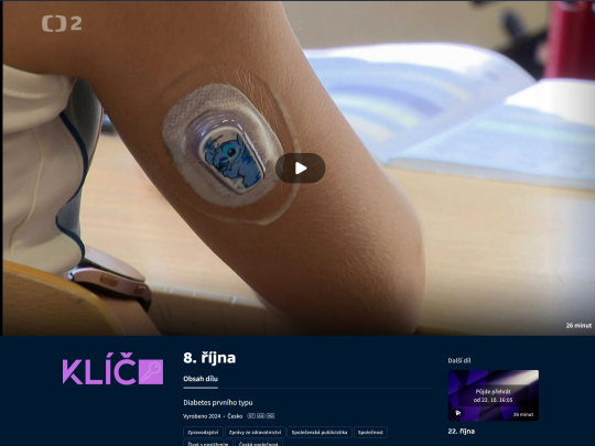 ČT 2 - Diabetes prvního typu