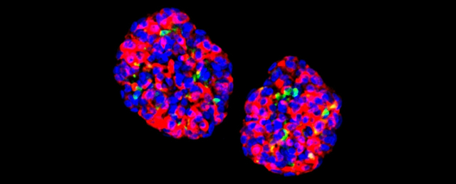 1a94412f-gastrocells.jpeg